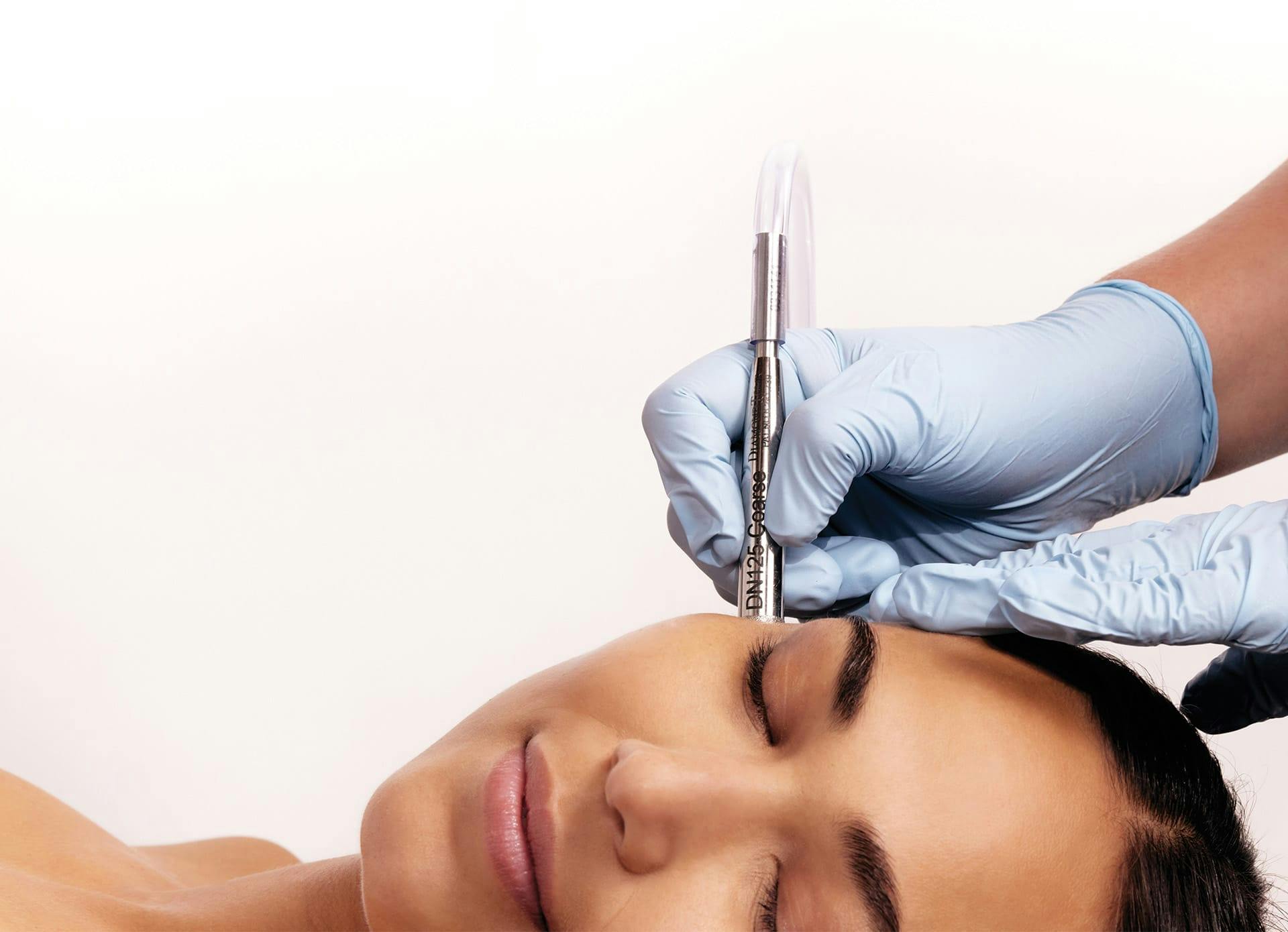 there is a woman receiving DiamondTouch treatment on the side of her face