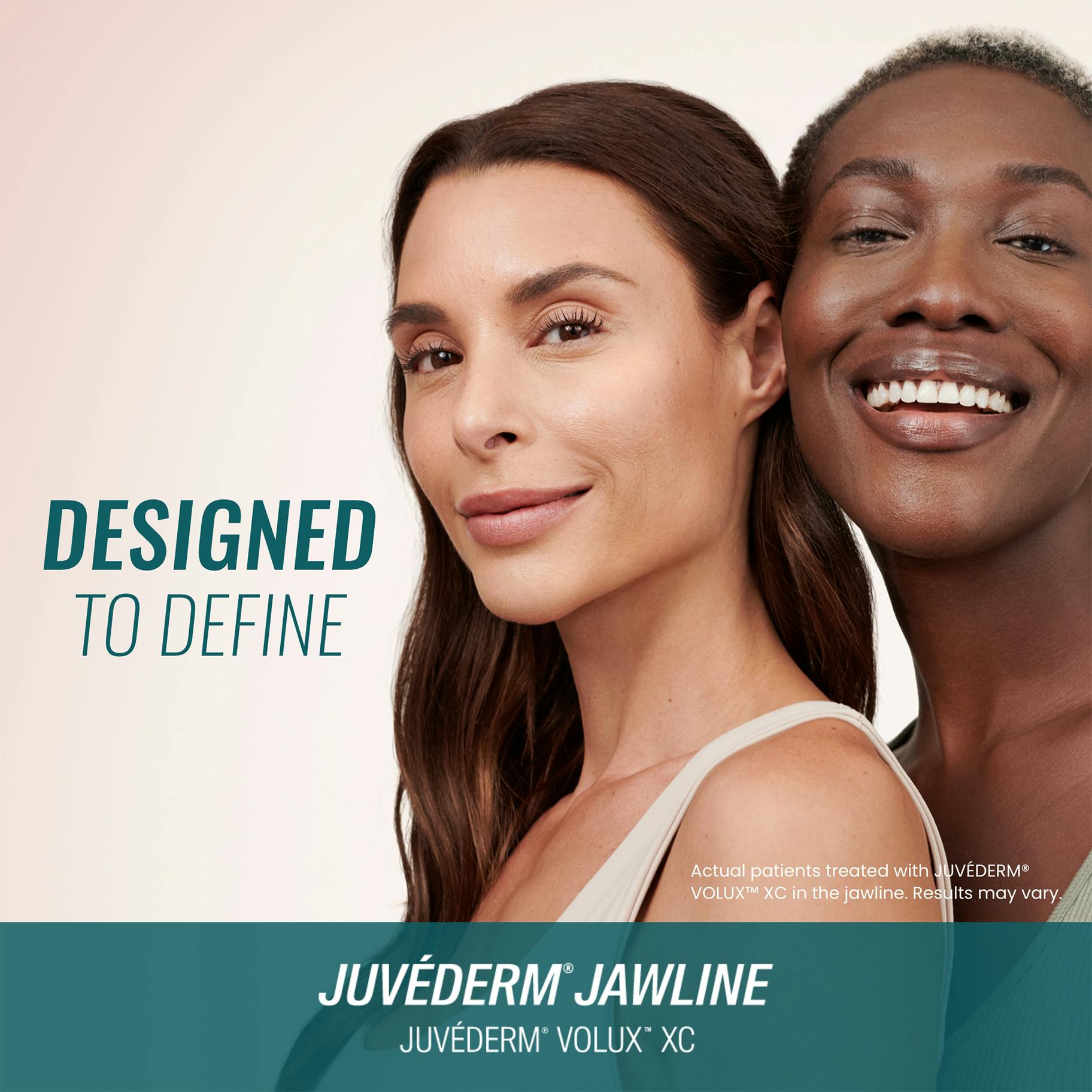juvederm volux jawline