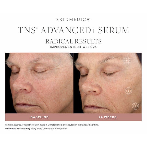 SkinMedica Before & After Gallery - Patient 177174510 - Image 1