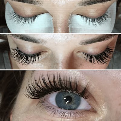 Lash Extensions Before & After Gallery - Patient 999230 - Image 1
