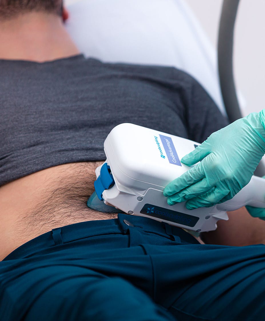 Man receiving CoolSculpting treatment in Arkansas