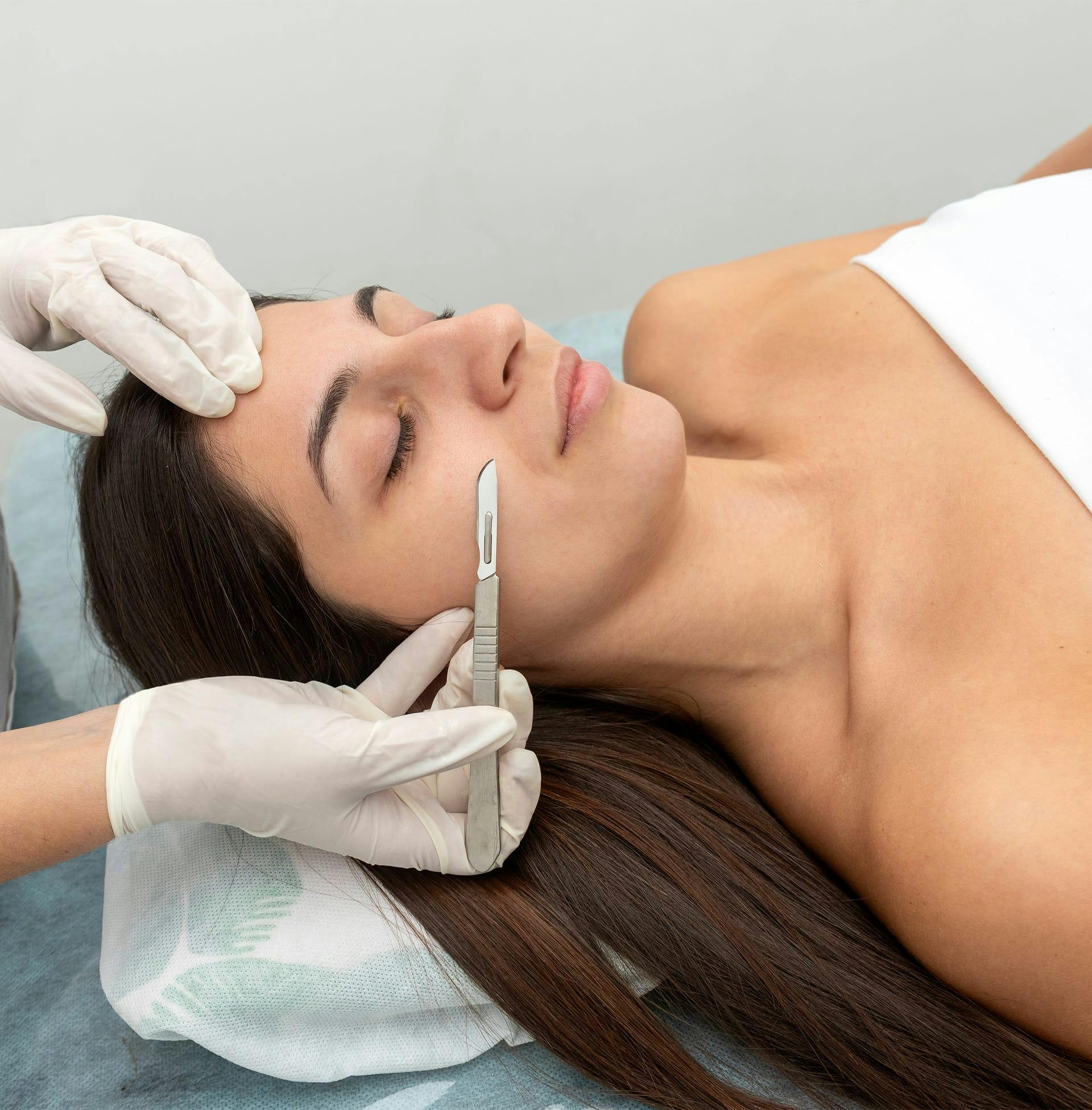 client in process of dermaplaning