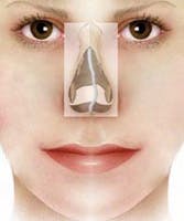 Septum nasal glossary