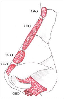 Nasal Reconstruction - Figure 4B