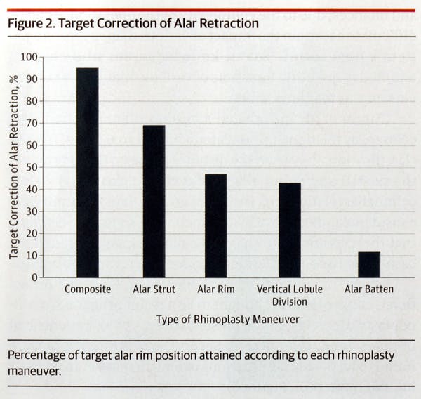 Alar Retraction: Etiology, Treatment, and Prevention - Figure 1