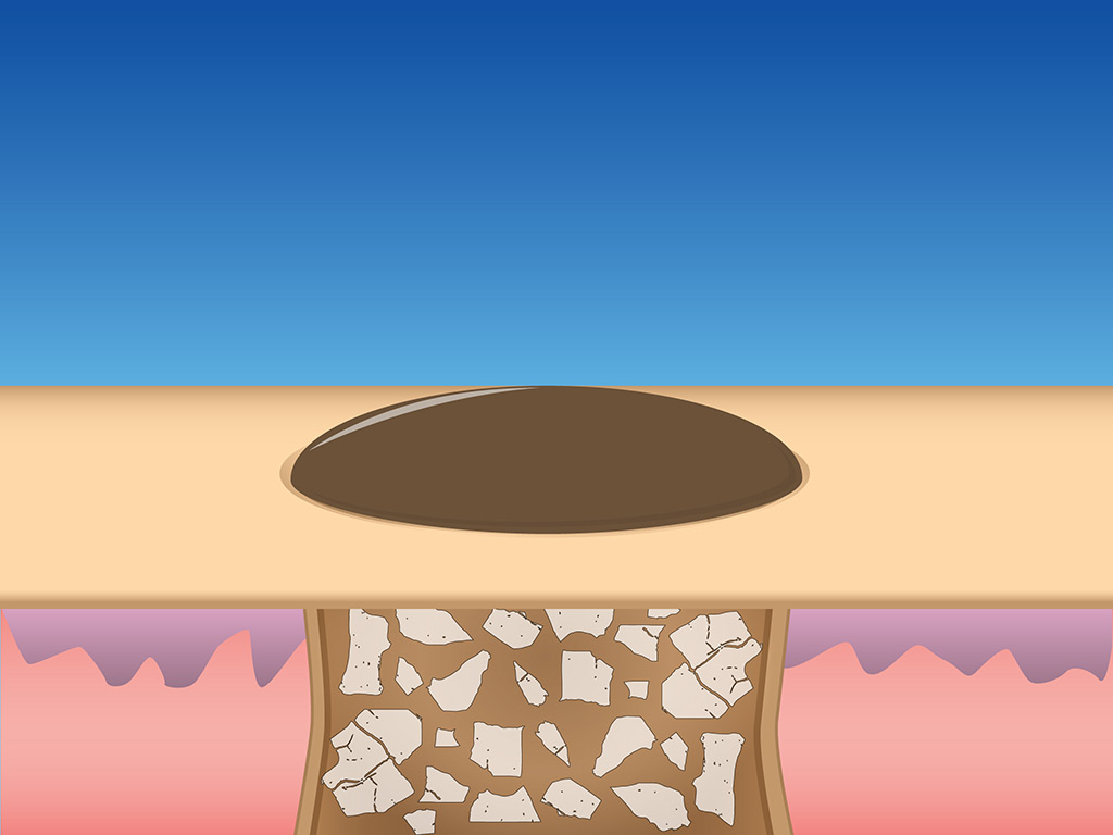skin repair illustration
