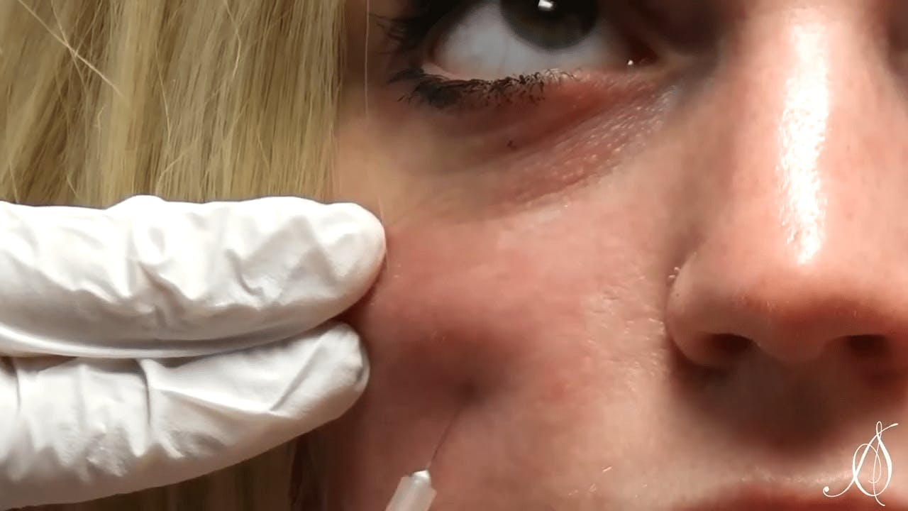 Woman receiving injectable treatment