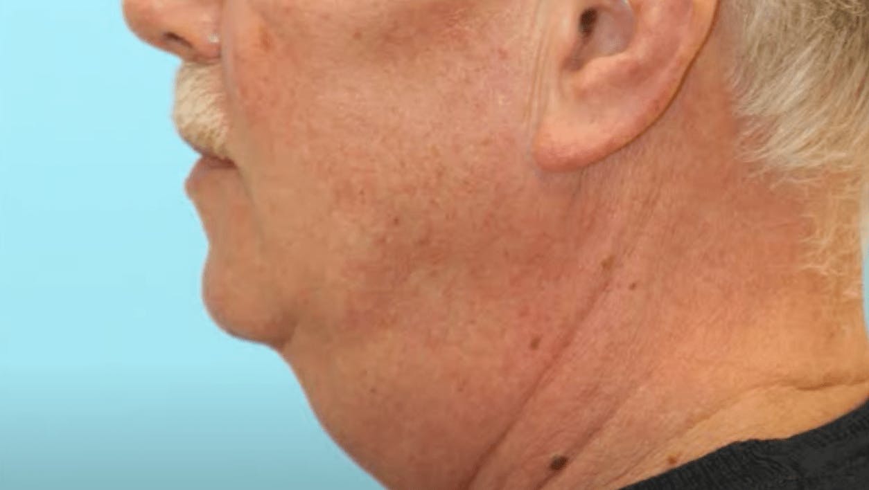 Side profile of man's neck