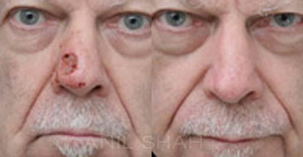Facial Reconstruction Before & After Gallery - Patient 265719 - Image 1
