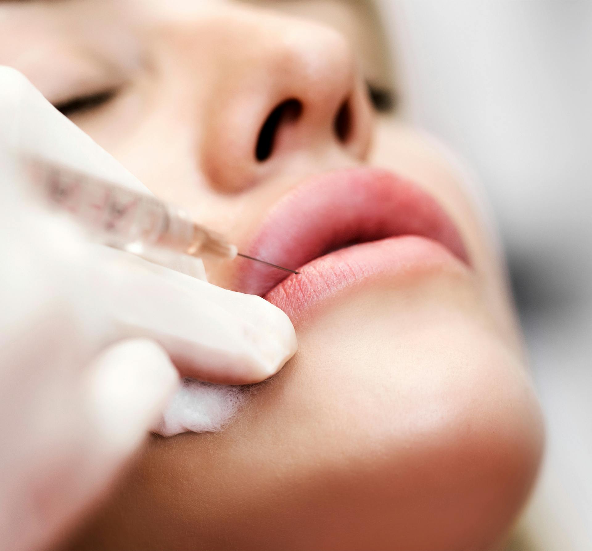 patient receiving juvederm