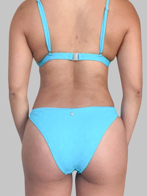 Brazilian Butt Lift Patient 188003904 After Back