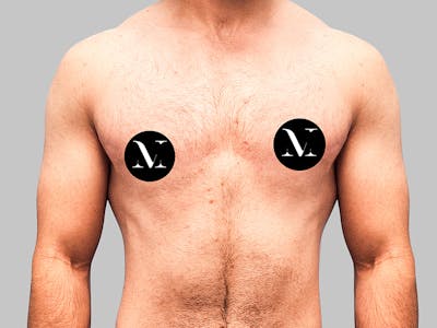 Top Surgery Before & After Gallery - Patient 188312693 - Image 2