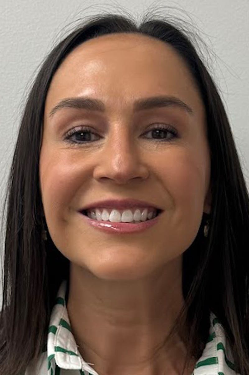 Injectables Before & After Gallery - Patient 325744 - Image 8