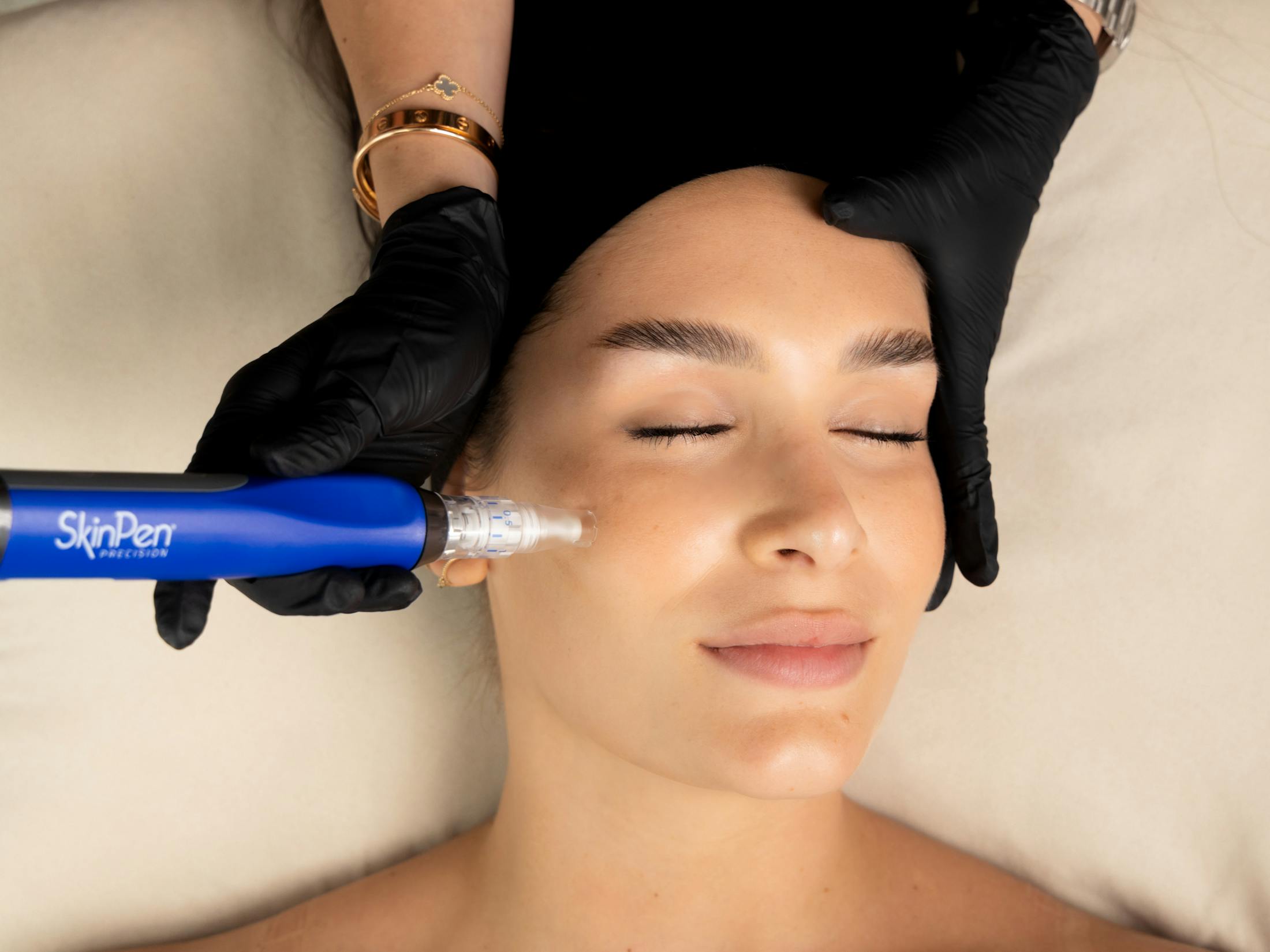 woman getting SkinPen microneedling
