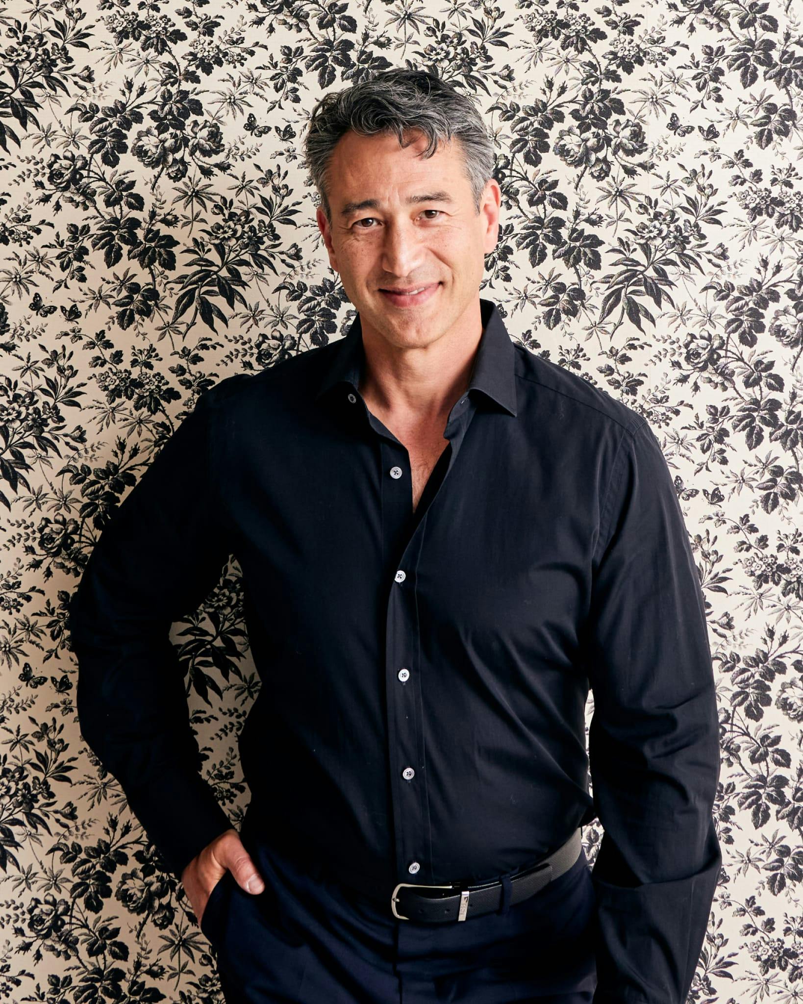 What To Expect Before And After Hip Dips Surgery Leif Rogers MD, violin hips delegacion.uc3m.es