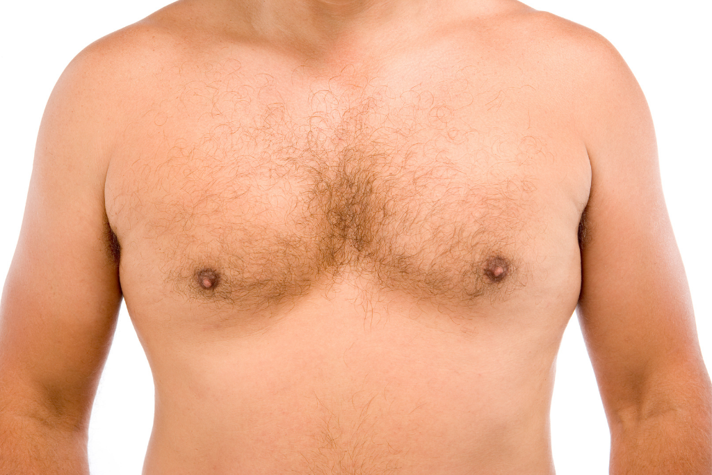Why do my nipples look erected, is it due to underdeveloped lower chest or  just fat? Or is it a genetic thing. How do i get rid of it, pls help. 