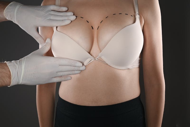 woman with a doctor's white gloved hands on her chest examining her breast
