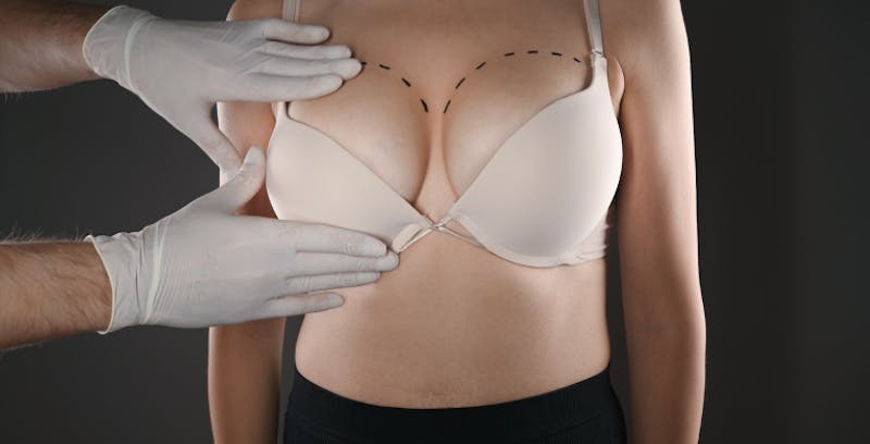 Doctor examining woman's breasts