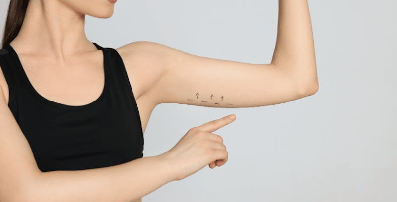 Womans arm