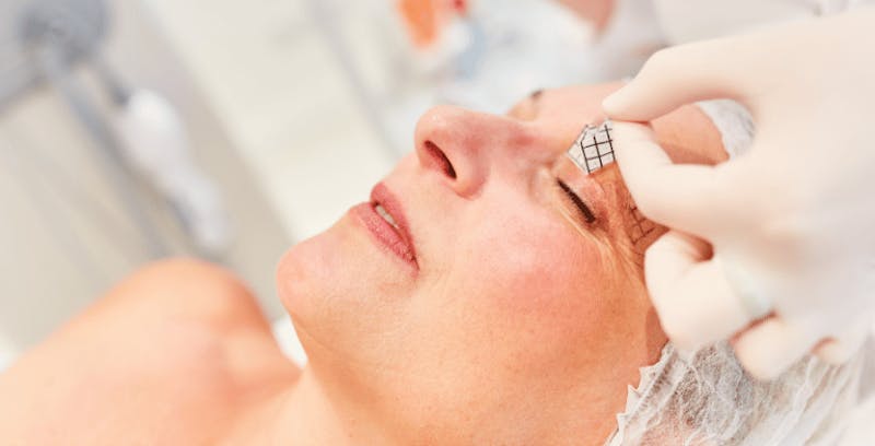picture of woman getting prepared for plastic surgery