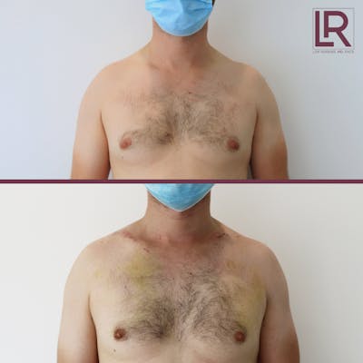 Patient results