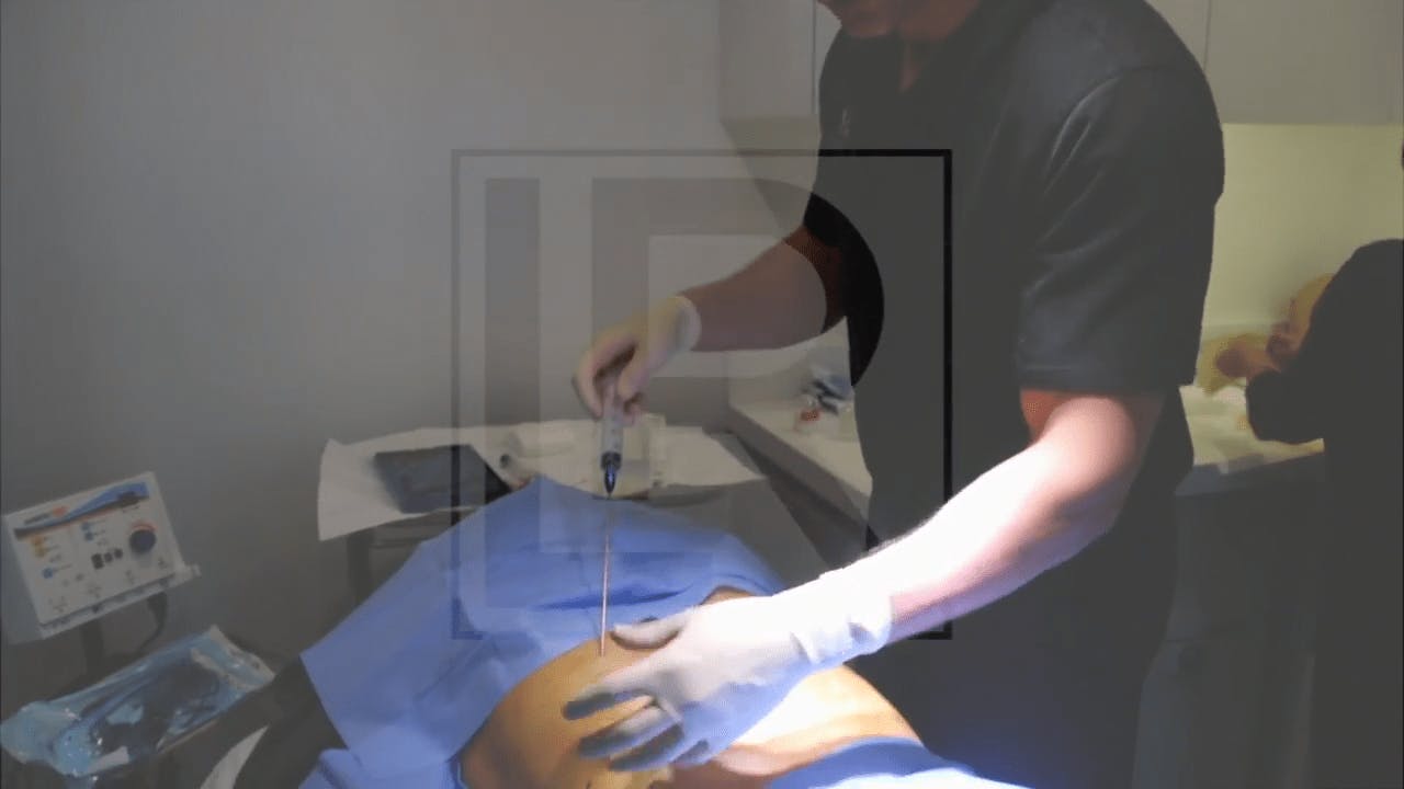 Dr. Leif Rogers performing plastic surgery