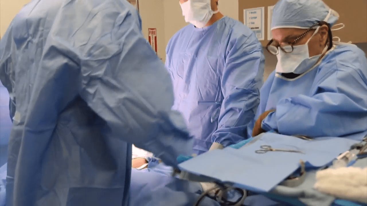 Liposuction surgery