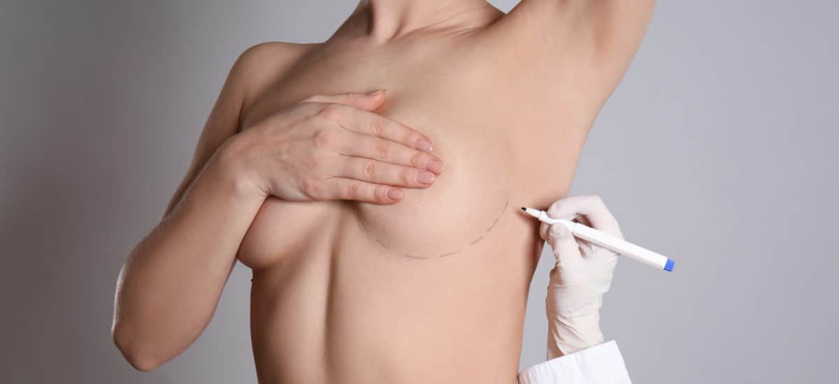Doctor drawing marks on female breast before cosmetic surgery operation against grey background