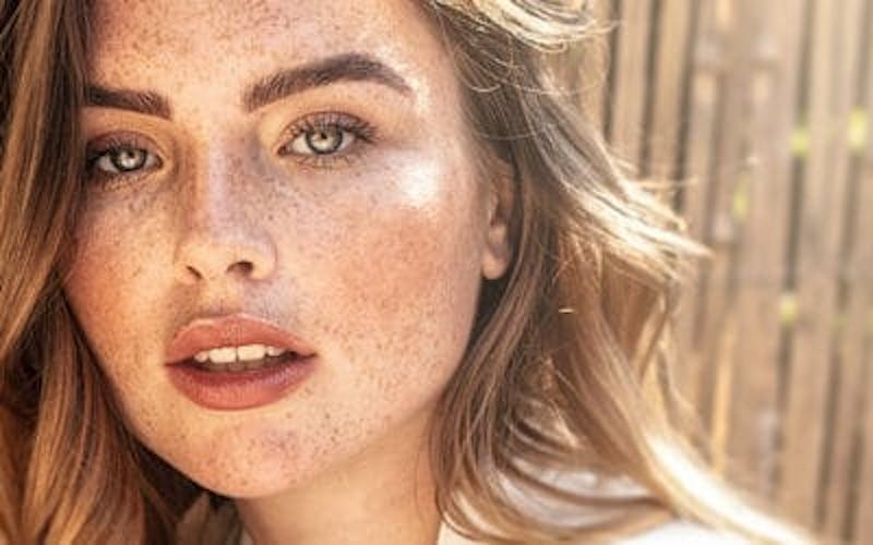 Woman with freckles