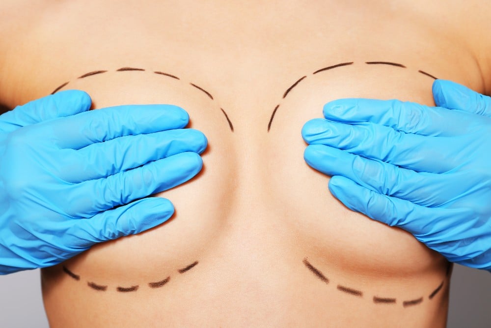 Breast augmentation prepping
