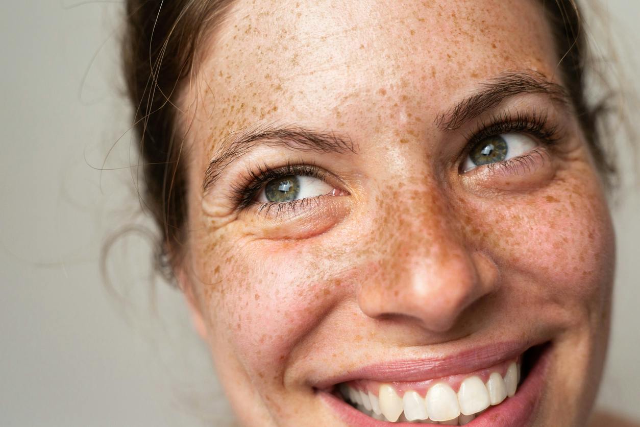 Woman with freckles and a hand on her cheek against a soft neutral background