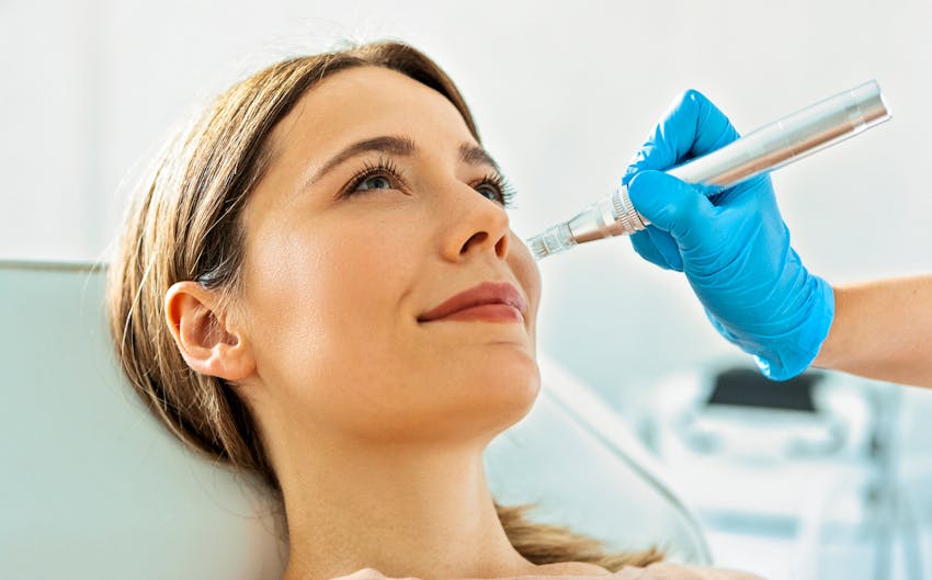 Woman smiling and receiving microneedling treatment