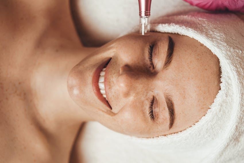 Woman getting microneedling