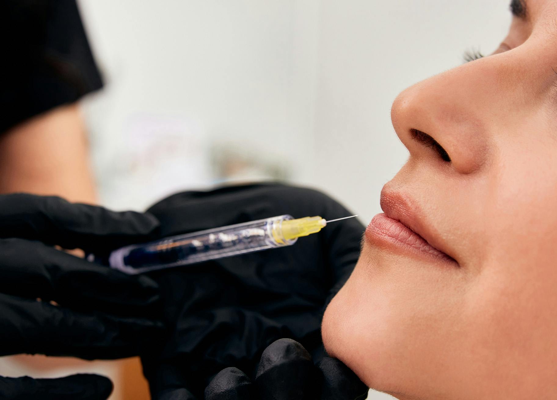 Woman getting lip fillers