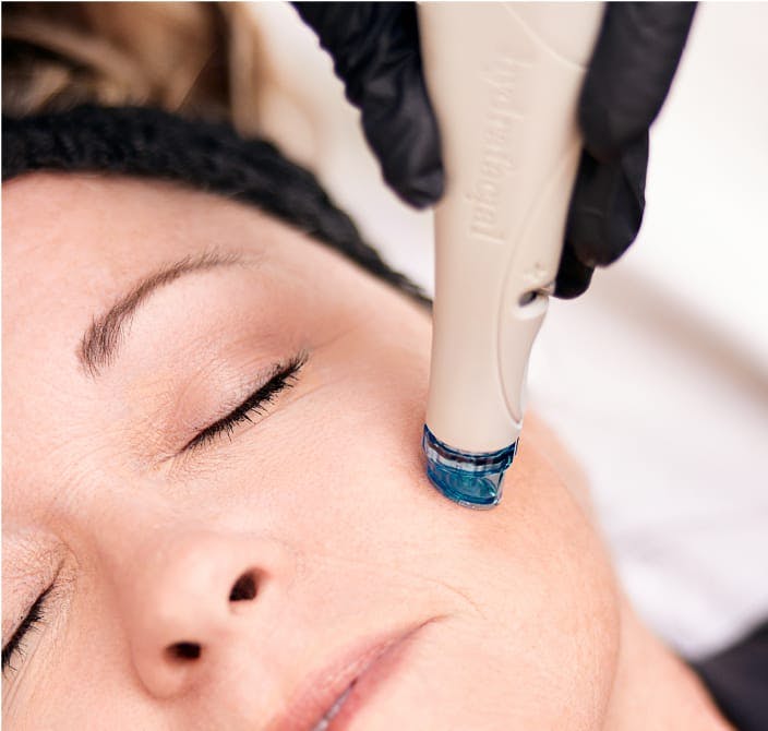 Woman undergoing a HydraFacial