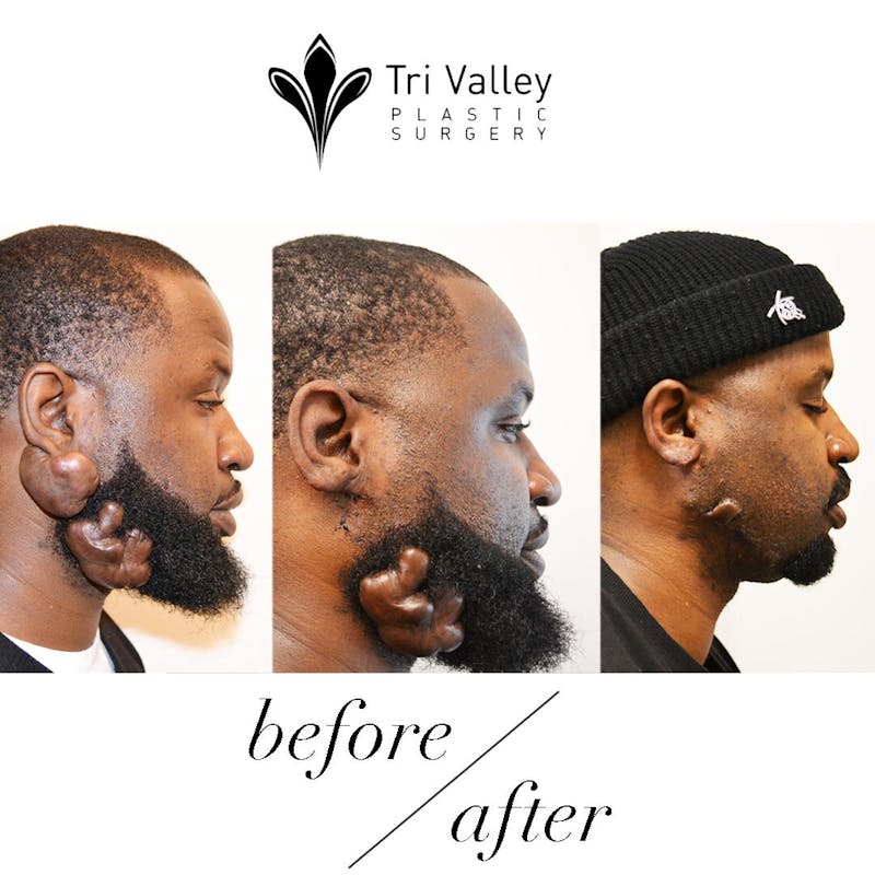 a man with a beard and a black hat