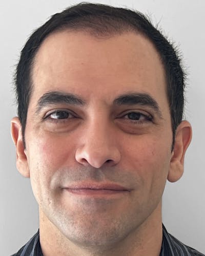 Blepharoplasty Before & After Gallery - Patient 357079 - Image 1
