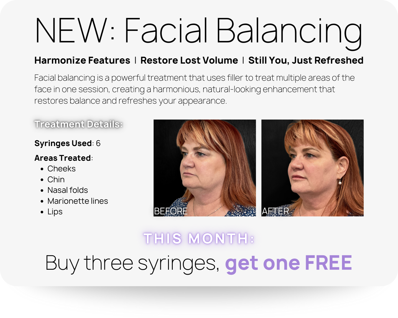Facial Balancing flyer