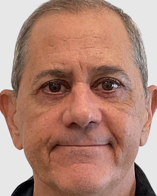 Blepharoplasty Before & After Gallery - Patient 364402 - Image 2