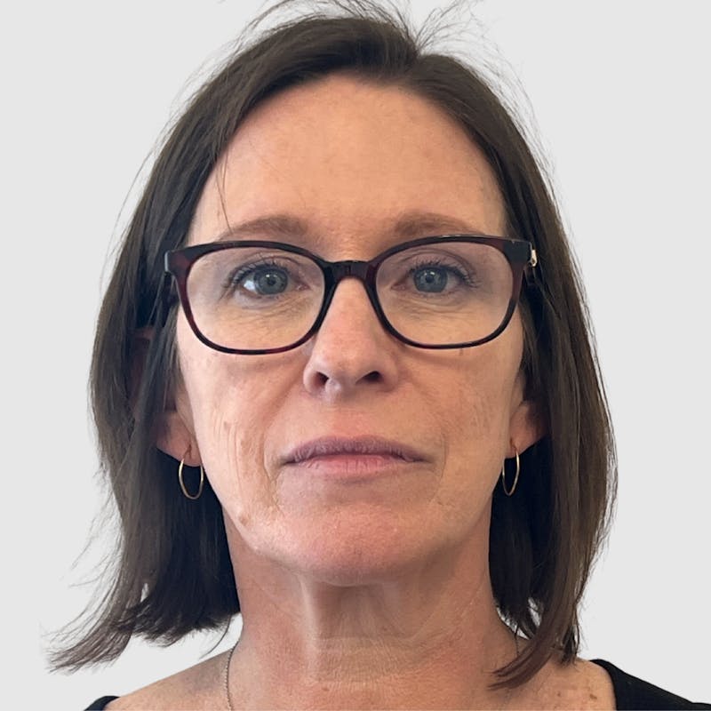 Face and Neck Lifts Before & After Gallery - Patient 424326 - Image 1