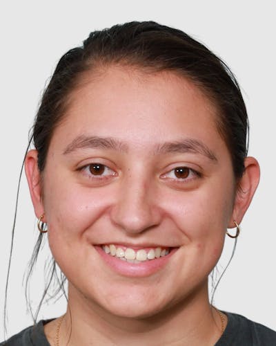 Rhinoplasty Before & After Gallery - Patient 297690 - Image 1