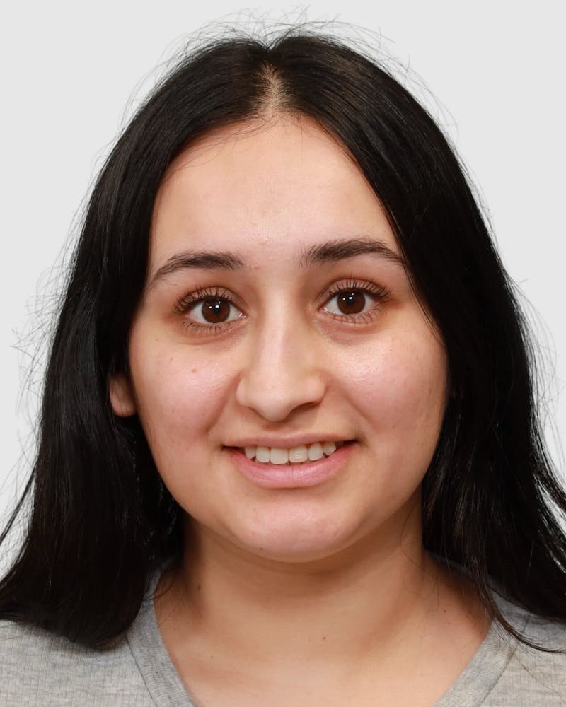 Rhinoplasty Before & After Gallery - Patient 167595 - Image 5