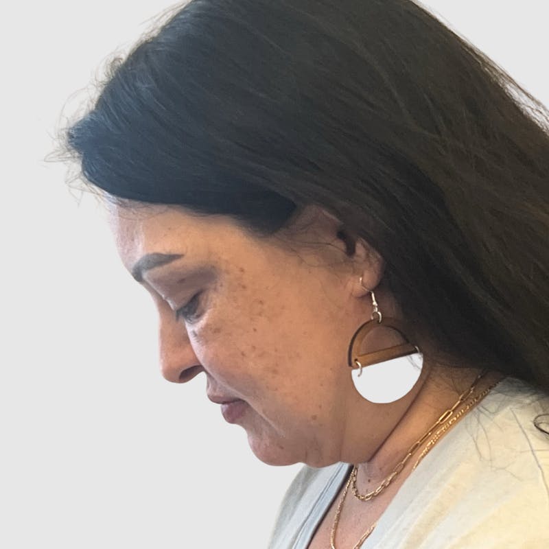 Face and Neck Lifts Before & After Gallery - Patient 219934 - Image 3