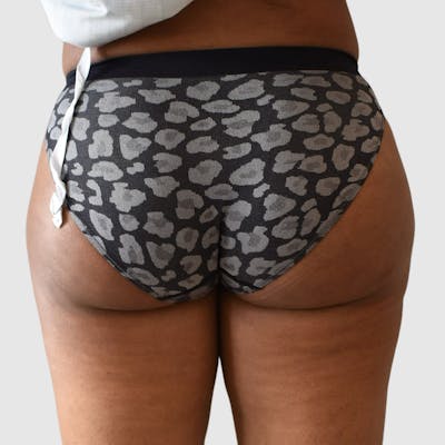 Brazilian Butt Lift Before & After Gallery - Patient 398105 - Image 2
