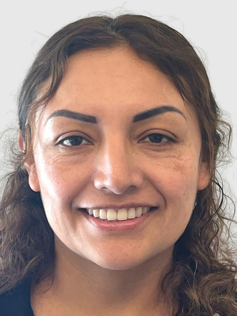 Rhinoplasty Before & After Gallery - Patient 278610 - Image 7