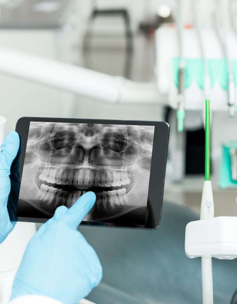 x-ray on tablet