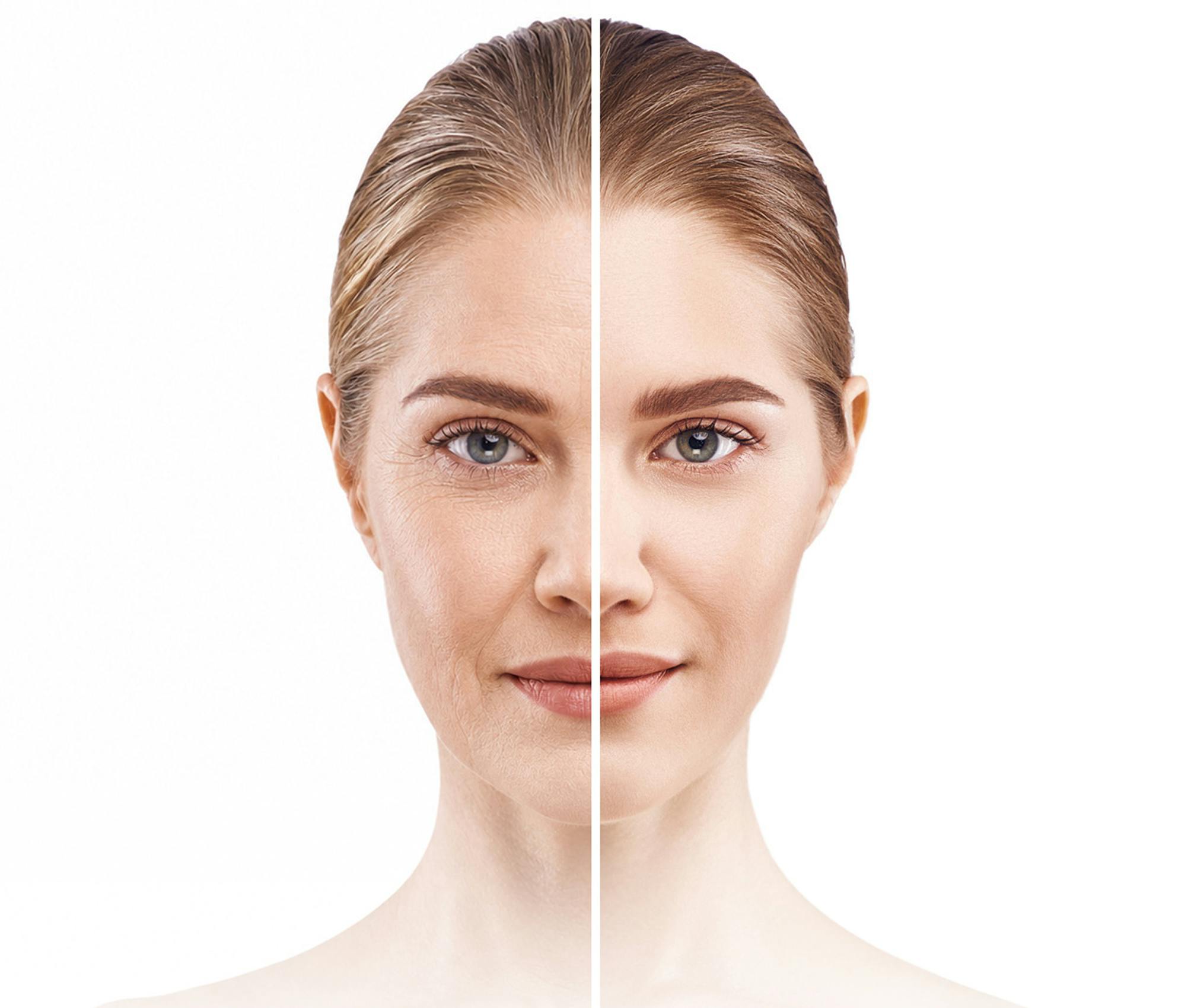 before/after image