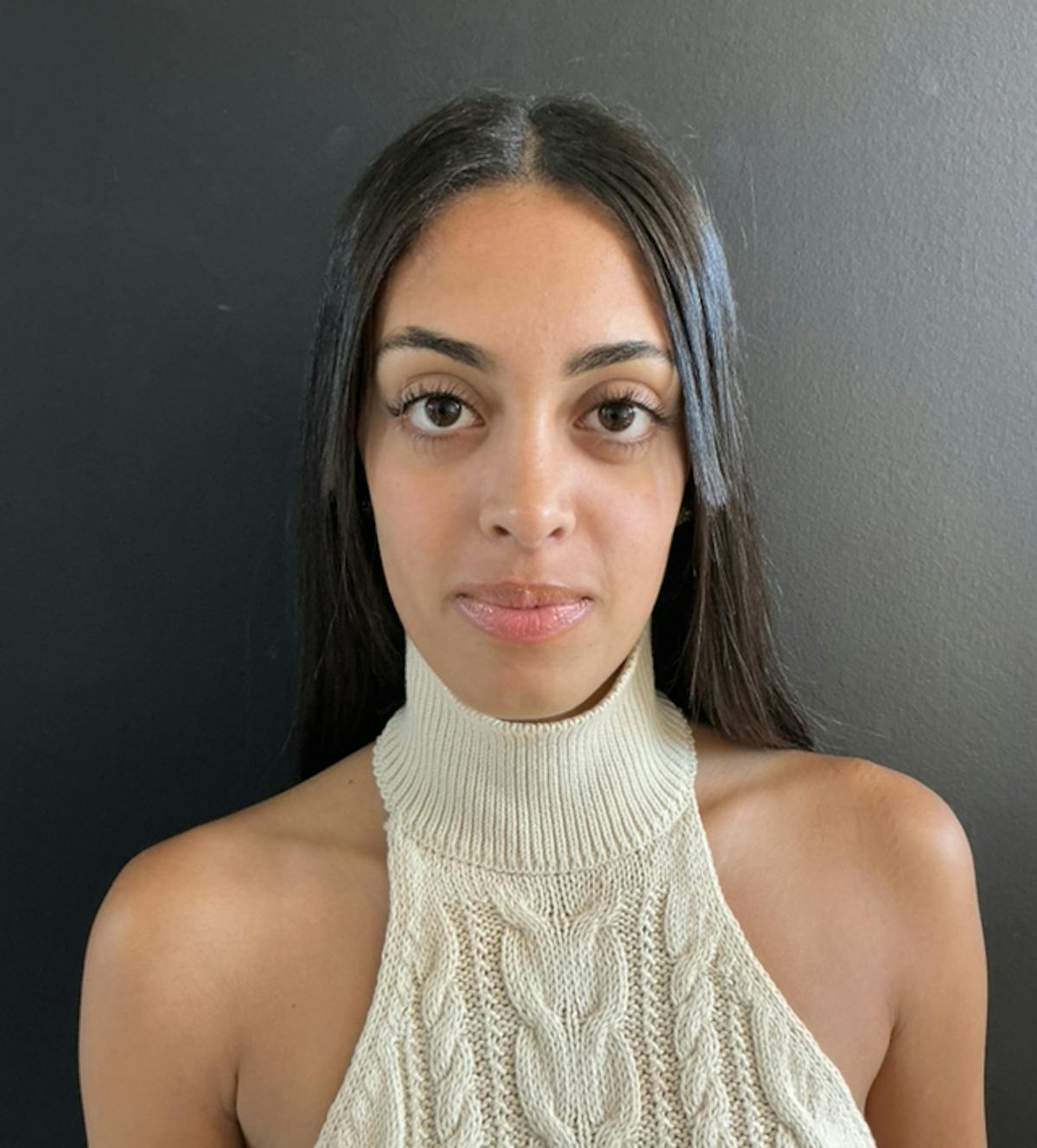 Dermal Fillers Before & After Gallery - Patient 274909 - Image 2