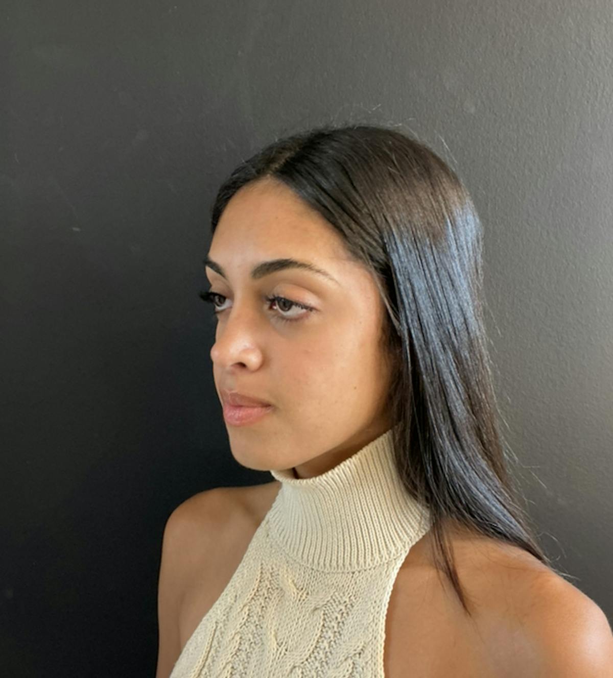 Dermal Fillers Before & After Gallery - Patient 274909 - Image 1
