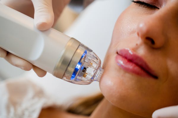 Patient getting microneedling